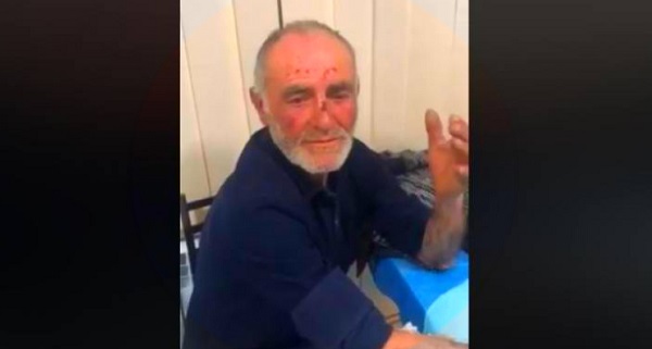 Պարետի թղթի բացակայության համար ոստիկանները ծեծել են հոր ու որդու. Նոր մանրամասներ