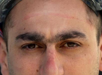  «Կորոնավիրուսի թողած սպիերը...». Արսեն Թորոսյանը լուսանկարներ է հրապարակել