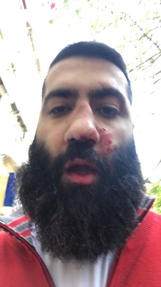 Արթուր Դանիելյանին ձերբակալել են և տարել Էրեբունի ԲԿ՝ վիրահատական միջամտության