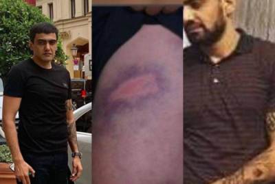 Գորիսի քաղաքապետը ծեծի է ենթարկել 30-ամյա երիտասարդի