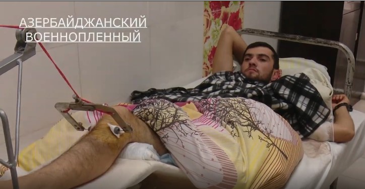 Հայ բժիշկները վիրահատել են ադրբեջանցի ռազմագերուն