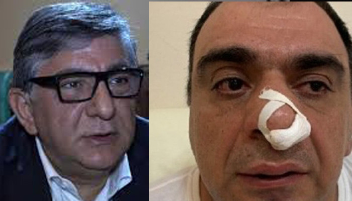 Մոսկվաբնակ գործարարին ծեծելու դեպքով քրգործ է հարուցվել